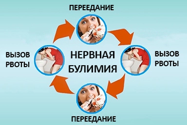 Лечение булимии в Навле